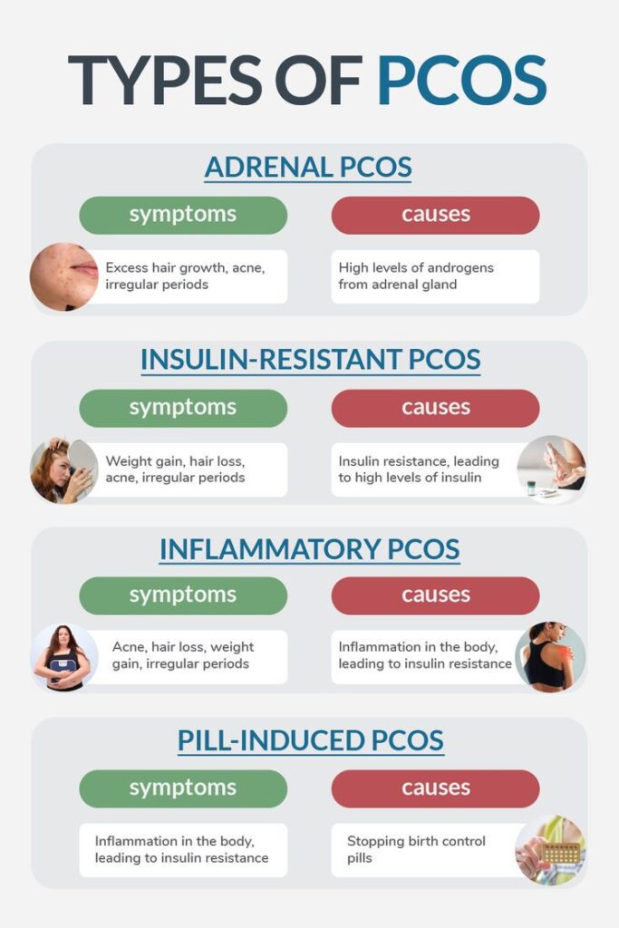 Symptoms of Pcod